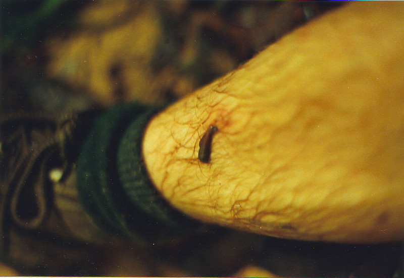 A leech attached to Mark's shin